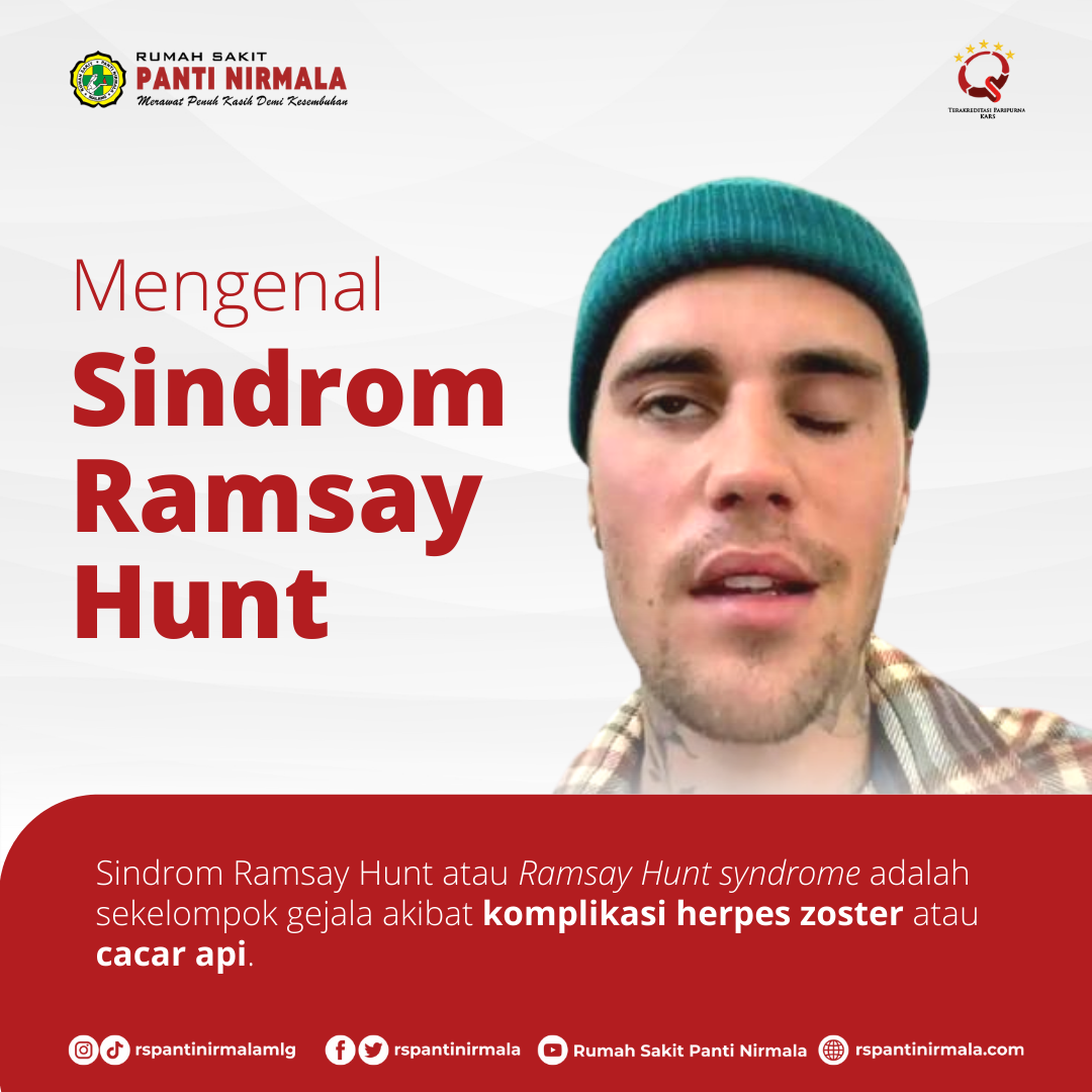 Mengenal Sindrom Ramsay Hunt