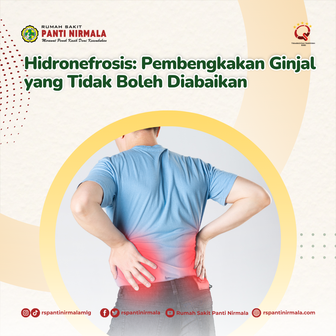 Hidronefrosis: Pembengkakan Ginjal yang Tidak Boleh Diabaikan