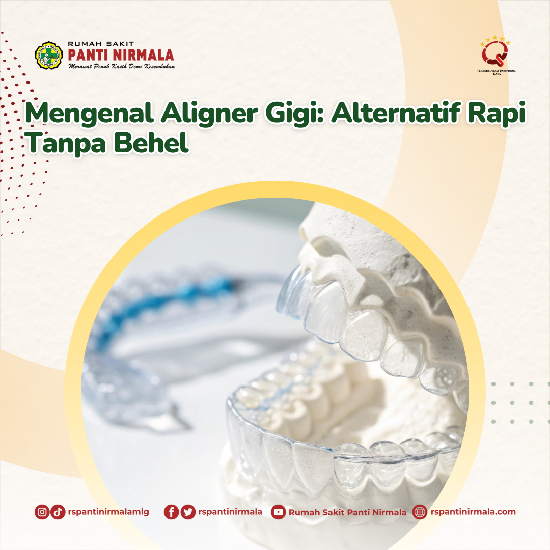 Mengenal Aligner Gigi: Alternatif Rapi Tanpa Behel